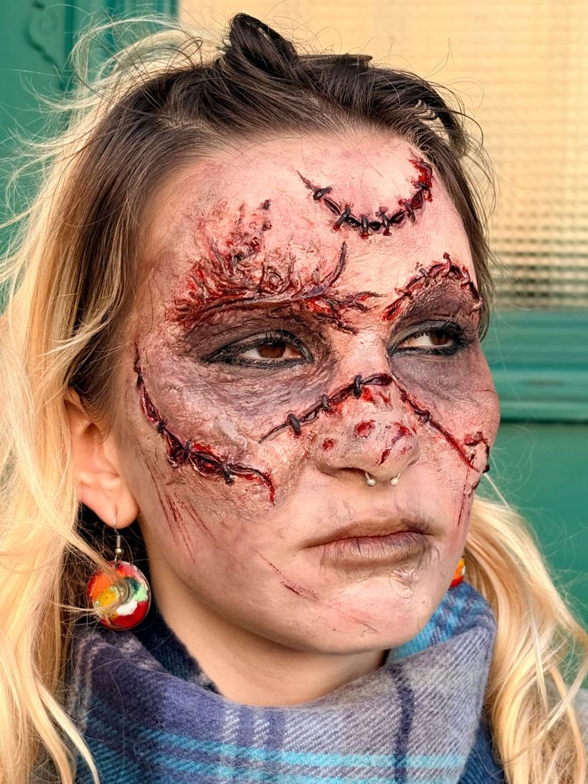 Full-face prosthetic: stitched lacerations, grafted skin, discoloured tissue